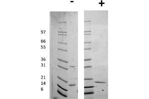 SDS-PAGE of Human Interleukin-16 Recombinant Protein SDS-PAGE of Human Interleukin-16 Recombinant Protein. (IL16 蛋白)