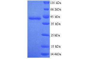 SDS-PAGE (SDS) image for Guanine Nucleotide Binding Protein (G Protein), alpha Activating Activity Polypeptide O (GNAO1) (AA 2-354) protein (His tag) (ABIN5713472)