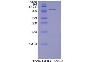 SDS-PAGE analysis of Rat PECAM1 Protein. (CD31 蛋白)