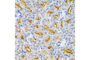 Immunohistochemistry of paraffin-embedded rat kidney using MyD88 Antibody (ABIN6128257, ABIN6144228, ABIN6144229 and ABIN6213986) at dilution of 1:100 (40x lens). (MYD88 抗体  (AA 60-309))