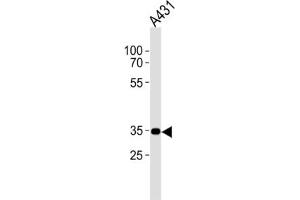 Western Blotting (WB) image for anti-Cannabinoid Receptor 2 (CNR2) antibody (ABIN2995770) (CNR2 抗体)