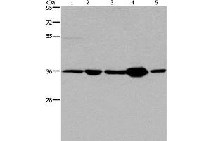 Western Blot analysis of Human transitional cell carcinoma tissue, 293T and A172 cell, Human testis tissue and Hela cell using LZTFL1 Polyclonal Antibody at dilution of 1:550