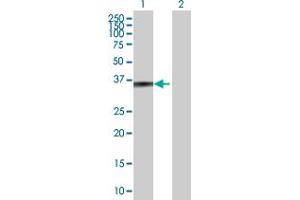 Western Blot analysis of ZADH1 expression in transfected 293T cell line by ZADH1 MaxPab polyclonal antibody. (PTGR2 抗体  (AA 1-351))