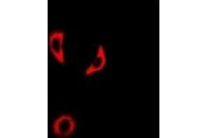 Immunofluorescent analysis of IL-18BP staining in A549 cells. (IL18BP 抗体)
