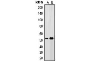 Western blot analysis of EP4 expression in Ramos (A), HeLa (B) whole cell lysates. (PTGER4 抗体  (Center))
