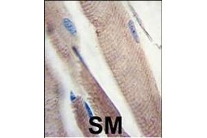 Formalin-fixed and paraffin-embedded human skeletal muscle tissue reacted with PI3KC3 Antibody , which was peroxidase-conjugated to the secondary antibody, followed by DAB staining. (PIK3C3 抗体  (AA 831-856))