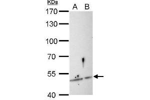 Western Blotting (WB) image for anti-Sestrin 3 (SESN3) antibody (ABIN2856855)