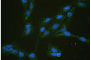 IF analysis of SLC2A5 using anti-SLC2A5 antibody (ABIN4886727).
