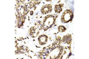 Immunohistochemistry of paraffin-embedded Human mammary gland using RPL13 antibody at dilution of 1:100 (x400 lens). (RPL13 抗体)