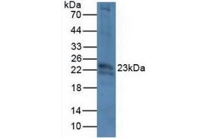 Detection of CRYbB2 in Mouse Eye Tissue using Polyclonal Antibody to Crystallin Beta B2 (CRYbB2) (CRYbB2 抗体  (AA 17-191))