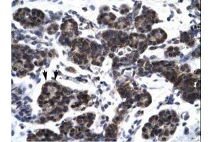Image no. 2 for anti-SMAD, Mothers Against DPP Homolog 3 (SMAD3) (N-Term) antibody (ABIN202493) (SMAD3 抗体  (N-Term))