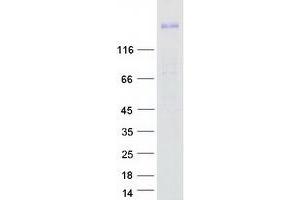 Western Blotting (WB) image for Roundabout, Axon Guidance Receptor, Homolog 1 (ROBO1) (Transcript Variant 3) protein (Myc-DYKDDDDK Tag) (ABIN2731104)