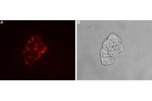 Expression of TRPC7 in rat PC12 cells - Cell surface detection of TRPC7 in intact living rat pheochromocytoma (PC12) cells using. (TRPC7 抗体  (2nd Extracellular Loop))