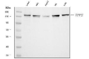 Western blot analysis of Tripeptidyl peptidase II/TPPII/TPP2 using anti-Tripeptidyl peptidase II/TPPII/TPP2 antibody (ABIN7601293).
