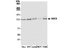 Western Blotting (WB) image for anti-SMC6 Structural Maintenance of Chromosomes 6-Like 1 (SMC6) (C-Term) antibody (ABIN7454597) (SMC6 抗体  (C-Term))