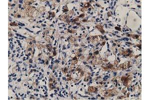 Image no. 8 for anti-Aldehyde Dehydrogenase 1 Family, Member L1 (ALDH1L1) antibody (ABIN1496585)