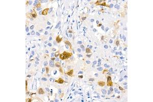 Immunohistochemistry (IHC) image for anti-Microtubule-Associated Protein 1 Light Chain 3 beta (MAP1LC3B) antibody (ABIN7268519)