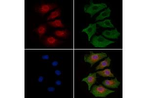 ABIN6262571 and ABIN6277224 staining HepG2 cells by IF/ICC. (Interleukin enhancer-binding factor 3 (ILF3) (Internal Region) 抗体)