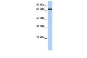 Image no. 1 for anti-Zinc Finger, DHHC-Type Containing 17 (ZDHHC17) (AA 398-447) antibody (ABIN6739194)