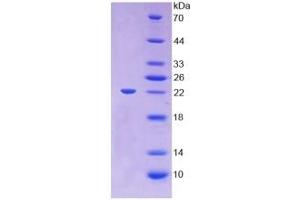 SDS-PAGE (SDS) image for Lecithin-Cholesterol Acyltransferase (LCAT) ELISA Kit (ABIN6720598)