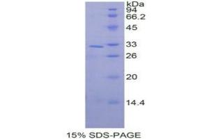 SDS-PAGE analysis of Human MAPK9 Protein. (JNK2 蛋白)