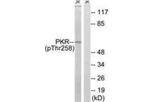 Western blot analysis of extracts from Jurkat cells treated with starved 24h, using PKR (Phospho-Thr258) Antibody. (EIF2AK2 抗体  (pThr258))