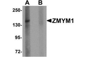 Western blot analysis of ZMYM1 in rat lung tissue lysate with ZMYM1 antibody at 1 μg/ml in (A) the absence and (B) the presence of blocking peptide. (ZMYM1 抗体  (C-Term))