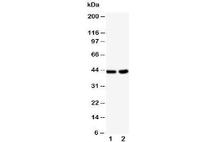 Western blot testing of BCAT1 antibody and Lane 1:  HeLa (BCAT1 抗体  (C-Term))