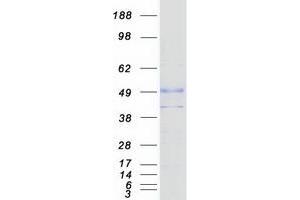 Western Blotting (WB) image for Solute Carrier Family 29 (Nucleoside Transporters), Member 2 (SLC29A2) protein (Myc-DYKDDDDK Tag) (ABIN2732170)