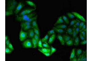 Immunofluorescence (IF) image for anti-Alanine Aminotransferase (ALT) (AA 2-496) antibody (ABIN7143616)