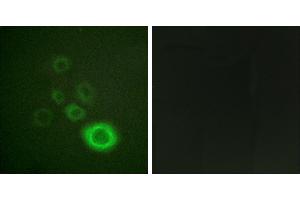 Peptide - +Western blot analysis of extracts from HepG2 cells, using c-Met (Ab-1003) antibody. (c-MET 抗体  (Tyr1003))