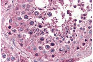 Human Testis (formalin-fixed, paraffin-embedded) stained with OPN3 antibody ABIN399999 at 5 ug/ml followed by biotinylated goat anti-rabbit IgG secondary antibody ABIN481713, alkaline phosphatase-streptavidin and chromogen. (OPN3 抗体  (Internal Region))