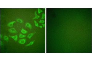 Iunofluorescence analysis of HepG2 cells, using P-10 antibody. (MMP10 抗体)