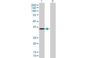 Western Blot analysis of CRHBP expression in transfected 293T cell line by CRHBP MaxPab polyclonal antibody. (CRHBP 抗体  (AA 1-322))