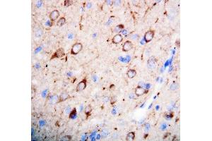 Anti-nNOS(neuronal) antibody, IHC(P) IHC(P): Rat Brain Tissue