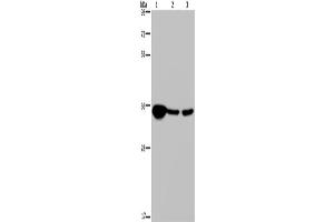 Western Blotting (WB) image for anti-Leucine Zipper Transcription Factor-Like 1 (LZTFL1) antibody (ABIN2430407)
