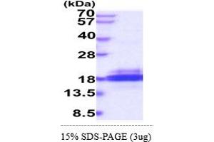 SDS-PAGE (SDS) image for SH2 Domain Containing 1B (SH2D1B) (AA 1-132) protein (His tag) (ABIN5854982) (SH2D1B Protein (AA 1-132) (His tag))