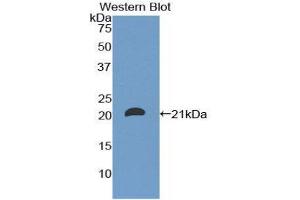 Western Blotting (WB) image for anti-CD8b Molecule (CD8B) (AA 22-170) antibody (ABIN1858318) (CD8B 抗体  (AA 22-170))