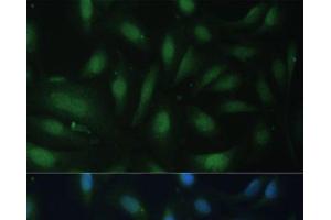 Immunofluorescence analysis of U-2 OS cells using CDKN1B Polyclonal Antibody at dilution of 1:100. (CDKN1B 抗体)
