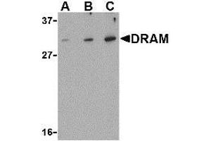 Western blot analysis of DRAM in K562 cell lysate with AP30305PU-N DRAM antibody at (A) 0. (DRAM 抗体  (N-Term))