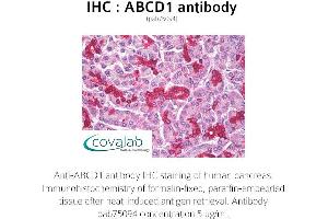 Image no. 1 for anti-ATP-Binding Cassette, Sub-Family D (Ald), Member 1 (ABCD1) antibody (ABIN1731416) (ABCD1 抗体)