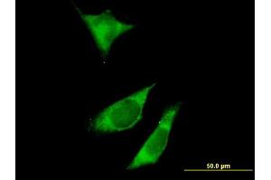 Immunofluorescence of purified MaxPab antibody to RPTOR on HeLa cell. (Raptor 抗体  (AA 1-379))