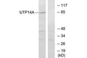 Western blot analysis of extracts from HeLa cells, using UTP14A Antibody. (UTP14A 抗体  (AA 321-370))