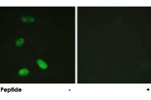 Immunofluorescence analysis of HeLa cells, using MYB polyclonal antibody . (MYB 抗体  (Ser12))