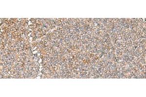 Immunohistochemistry of paraffin-embedded Human tonsil tissue using GIMAP2 Polyclonal Antibody at dilution of 1:60(x200) (GIMAP2 抗体)