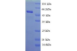 SDS-PAGE (SDS) image for Adenosylhomocysteinase (AHCY) (AA 1-448), (full length) protein (His tag) (ABIN5712924) (AHCY Protein (AA 1-448, full length) (His tag))