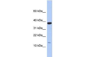 WB Suggested Anti-RPL27 Antibody Titration: 0. (RPL27 抗体  (Middle Region))