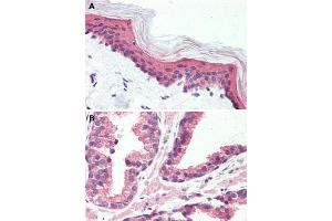 Immunohistochemical staining of human skin (A) and human prostate (B) with GPR126 polyclonal antibody . (G Protein-Coupled Receptor 126 抗体  (N-Term))