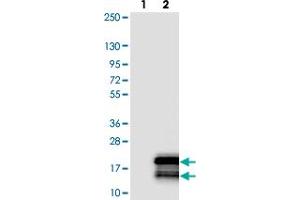 Western blot analysis of Lane 1: Negative control (vector only transfected HEK293T lysate). (TYROBP 抗体)