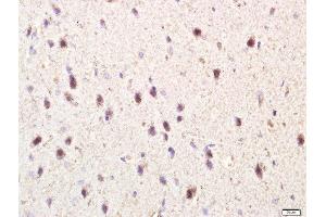 Paraformaldehyde-fixed, paraffin embedded rat brain tissue, Antigen retrieval by boiling in sodium citrate buffer(pH6) for 15min, Block endogenous peroxidase by 3% hydrogen peroxide for 30 minutes, Blocking buffer (normal goat serum) at 37°C for 20min, Antibody incubation with Rabbit Anti-TLR3 Polyclonal Antibody, Unconjugated  at 1:400 overnight at 4°C, followed by a conjugated secondary and DAB staining (TLR3 抗体  (AA 801-905))